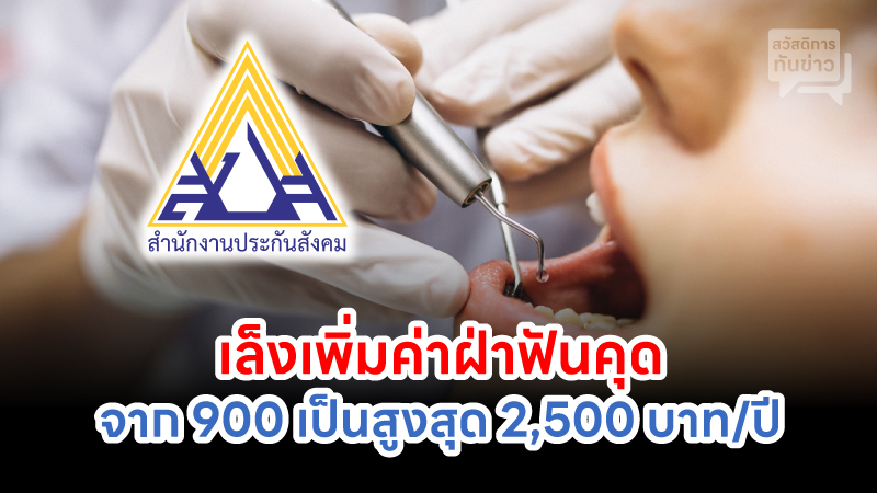 ประกันสังคม เล็งเพิ่มค่าฝ่าฟันคุด จาก 900 เป็นสูงสุด 2,500 บาท/ปี